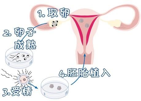 林院长